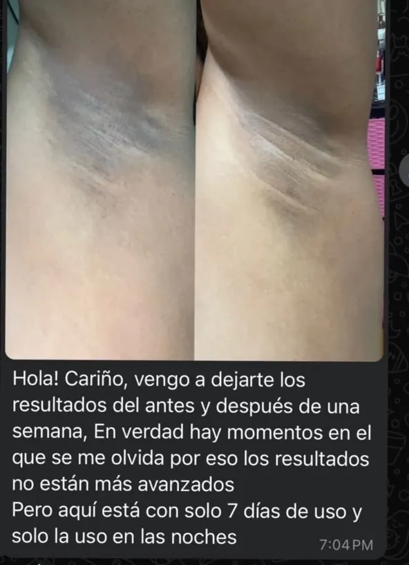 Evidencia real de cliente SKIN COSMETICS